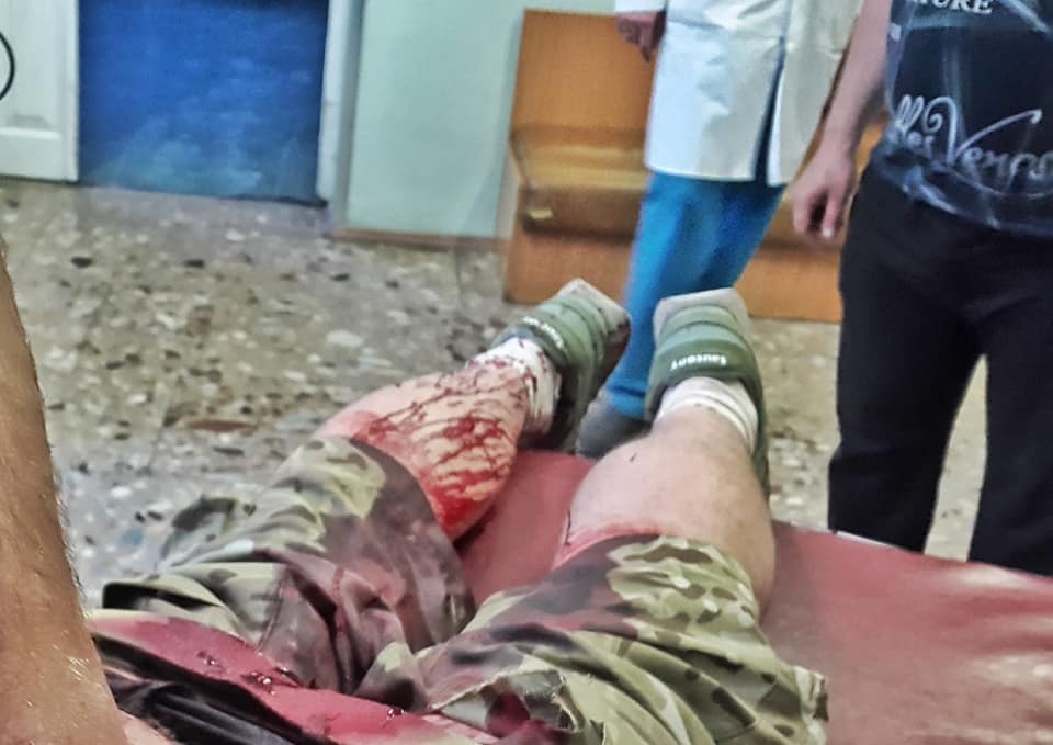 В Киеве банда в масках напала с ножом на "киборга": все подробности