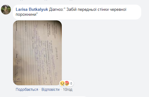 Лаявся і бив по печінці: в Києві охоронець ТЦ напав на дитину