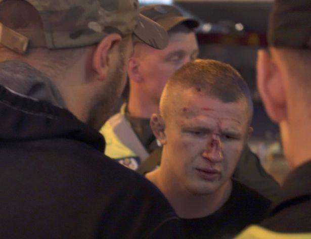 Избиение фанов "Ливерпуля" в Киеве: появились фото побоища