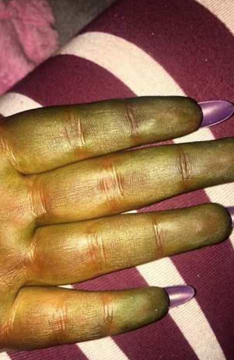 Шкіра на руках Денні Брюс позеленіла