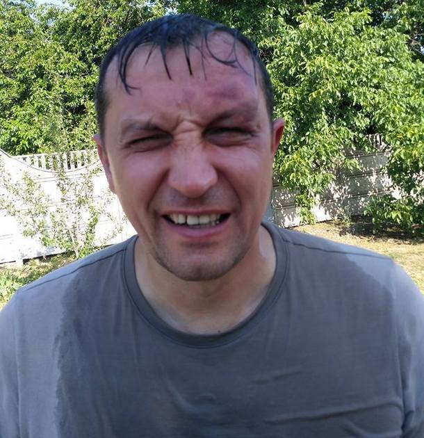 В Кривом Роге жестко избили депутата: опубликованы фото