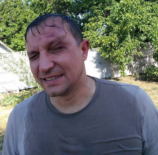 В Кривом Роге жестко избили депутата: опубликованы фото