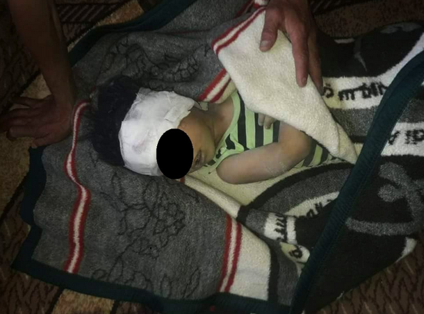 Сили Асада розбомбили дитячу лікарню: є загиблі