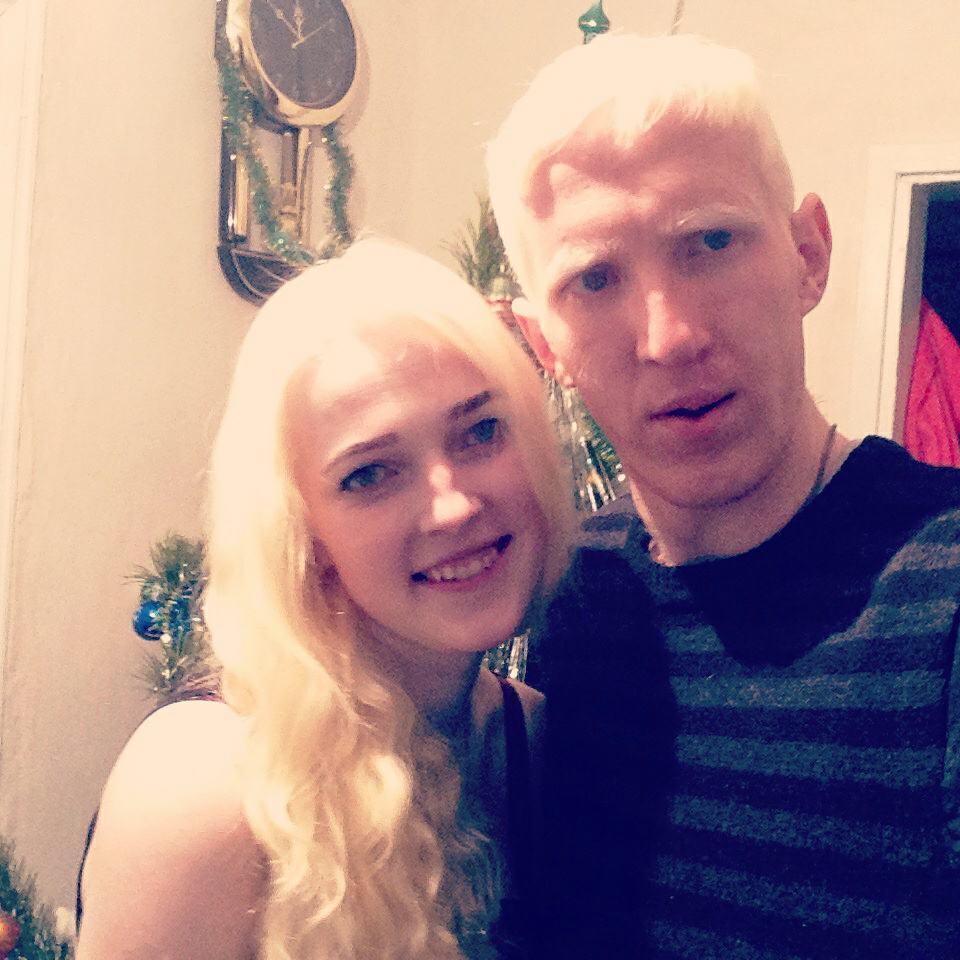 "Почему он такой белый?" Как живут альбиносы в Украине