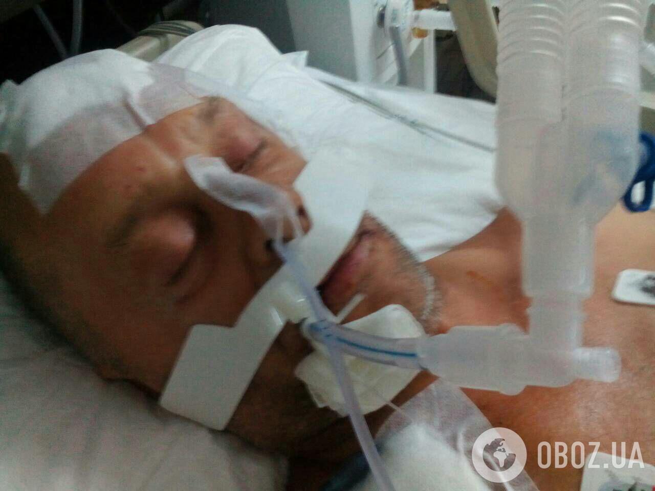 "Из-за проигрыша сборной": жестоко избитого россиянином украинца бросили в Турции в коме