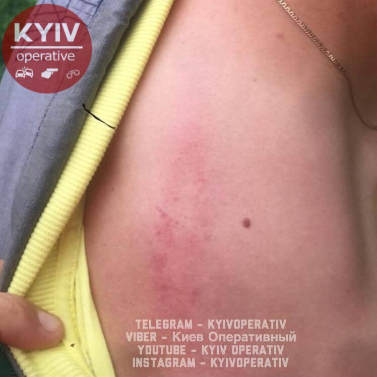 В Киеве ромы жестоко избили прохожего: опубликованы фото 