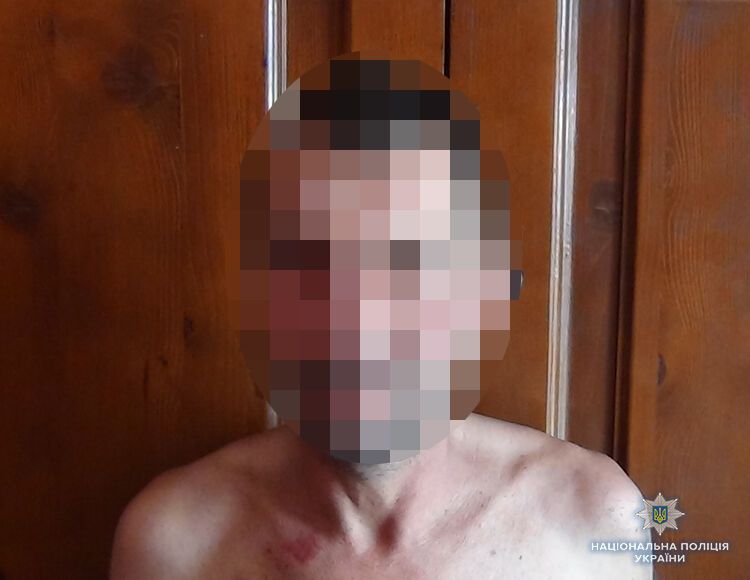 В Запорожской области мужчина забил до смерти собутыльника