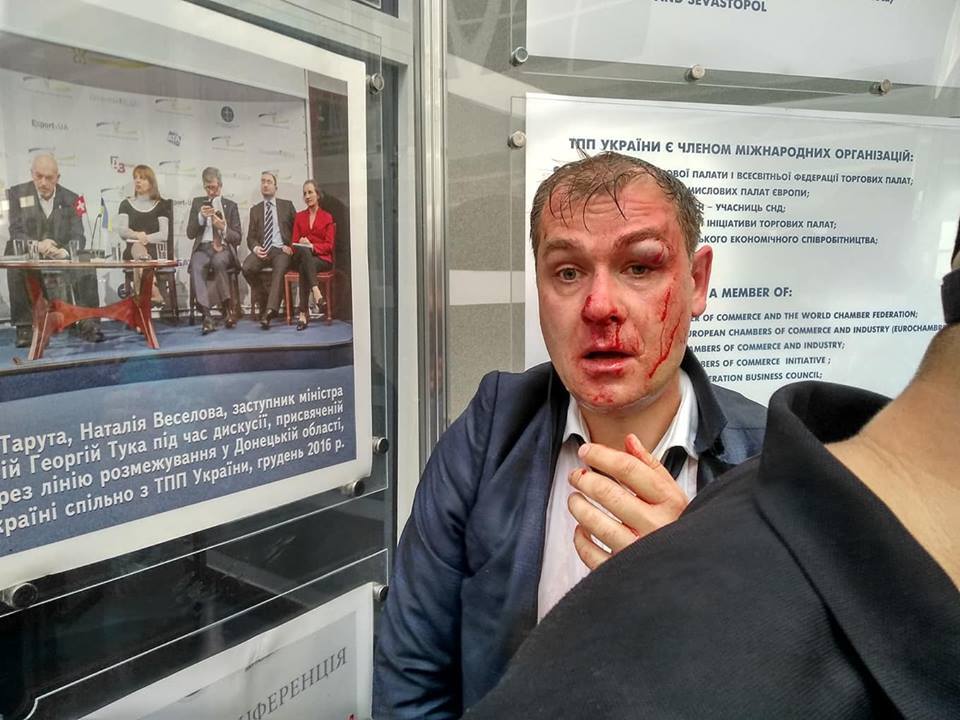 "Связан с Россией и "киллером" Бабченко": появились новые подробности избиения политика в Киеве