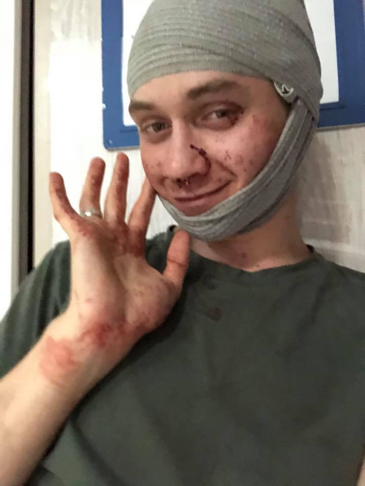 Лицо залило кровью: в Киеве жестоко избили активиста. Появились фото