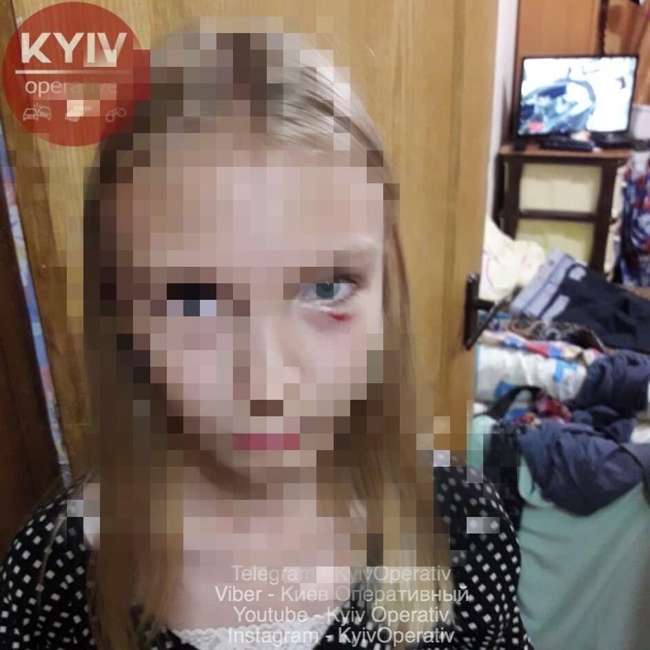 В Киеве женщина накинулась на ребенка: фото