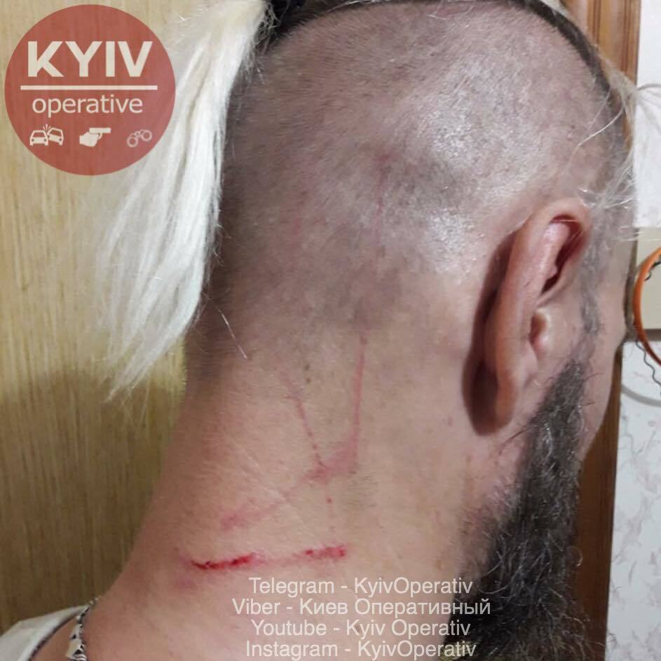 Била по голові та нирках: у Києві жінка накинулася на дитину