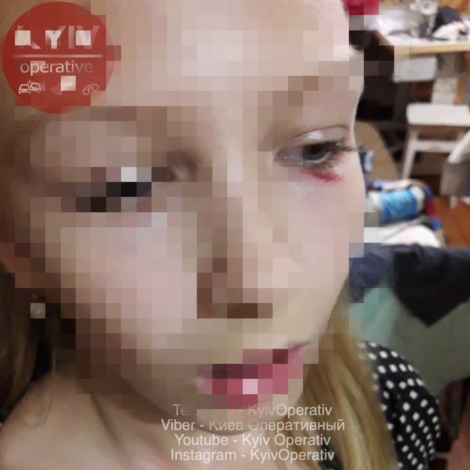 Била по голові та нирках: у Києві жінка накинулася на дитину