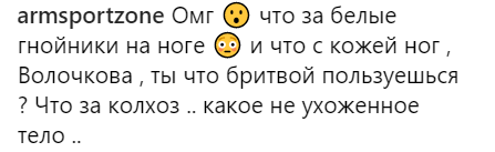 "Тепер не засну": Волочкова показала знівечені ноги