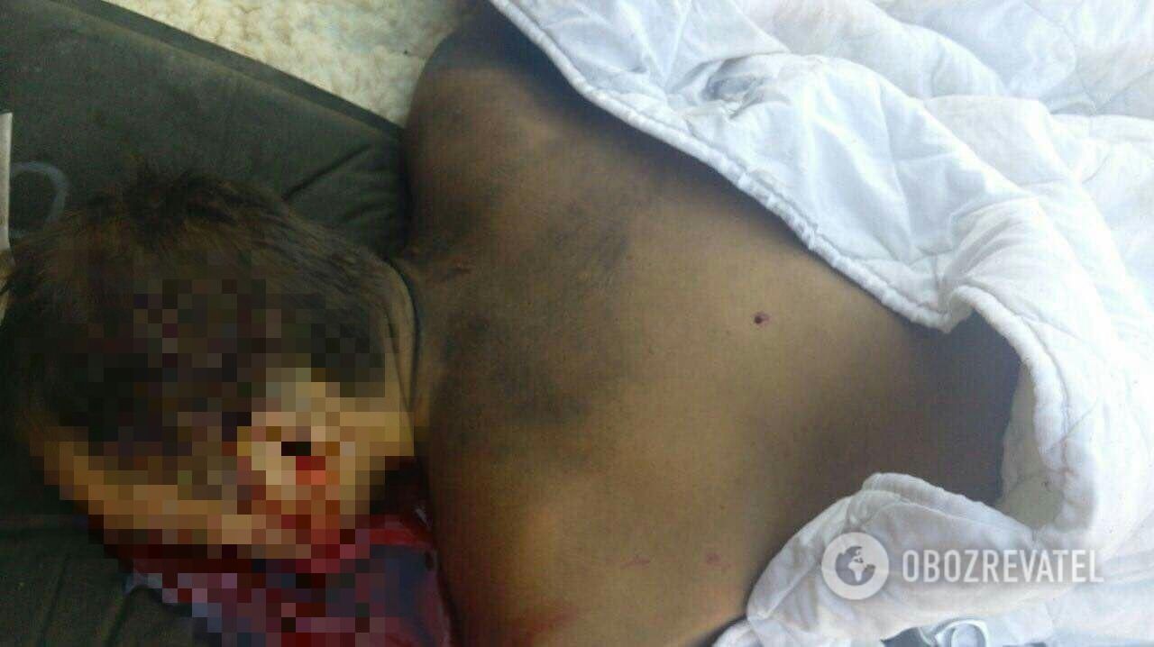 В Сумах застрелили экс-чиновника: первые кровавые фото с места убийства, 18+