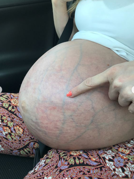  "Ужасно и прекрасно": беременная женщина стала звездой сети из-за своего живота