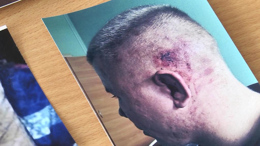 Кулаком в лицо: известную украинскую журналистку жестоко избили во время съемок в интернате