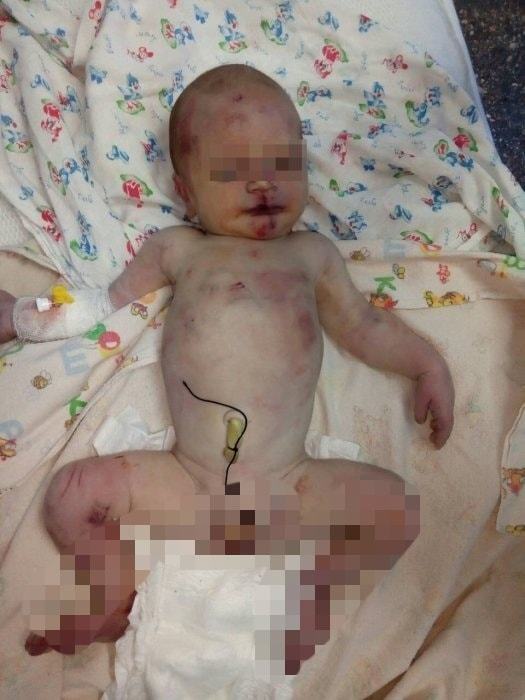 ''Розстріляти!'' Українців розлютило ''побиття'' немовляти. Моторошні фото