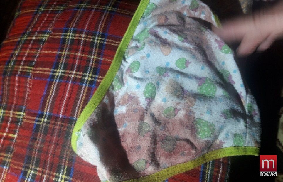Прямо в кроватке: в Мариуполе крыса чуть не загрызла 4-летнюю малышку