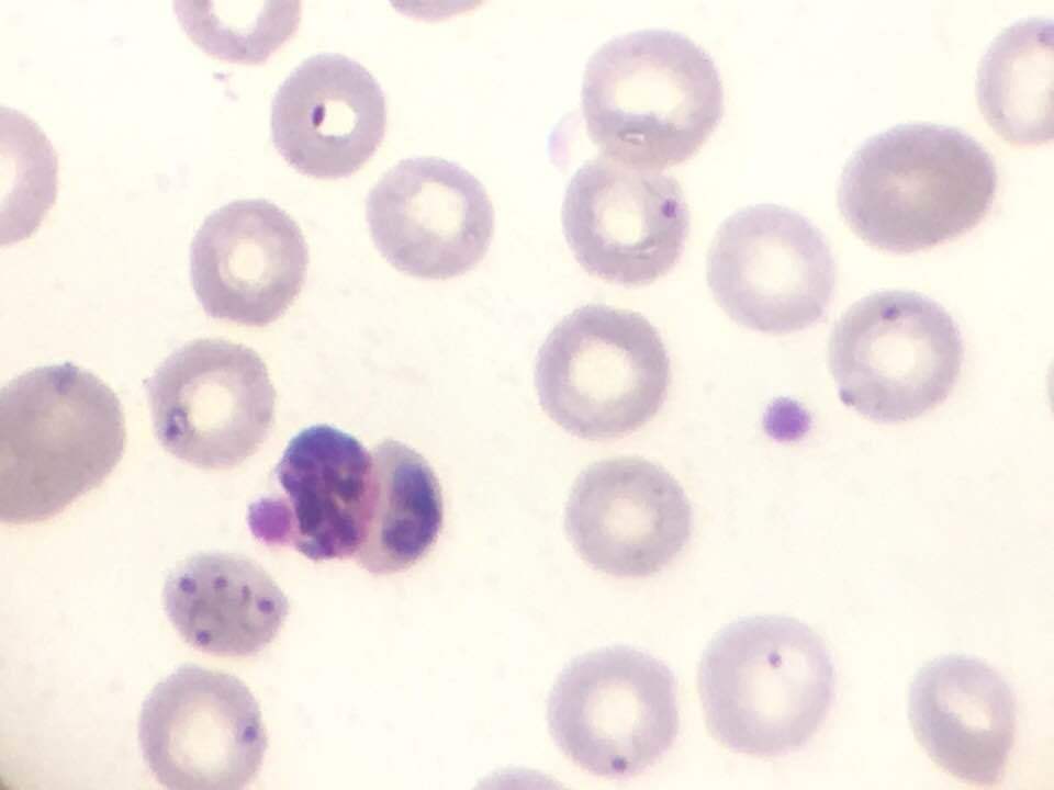 Лабораторная диагностика: малярия 