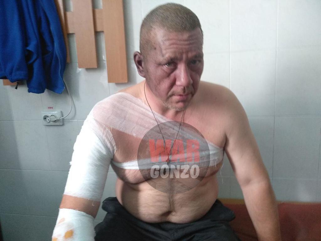 У центрі Донецька стався вибух: постраждав кандидат на пост ватажка