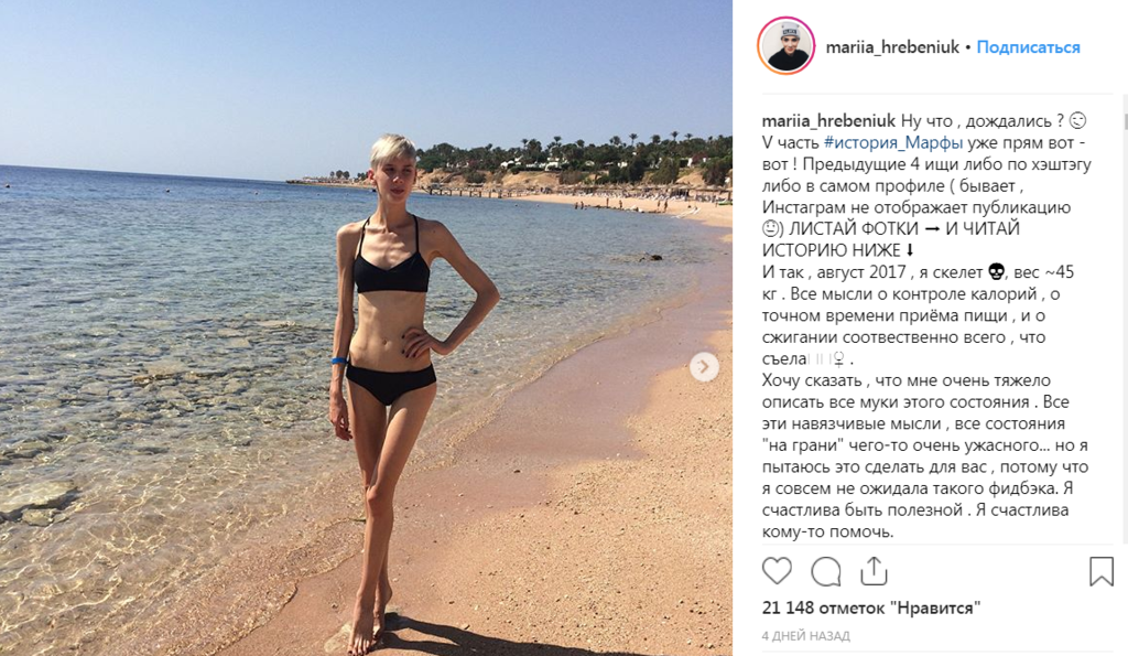  "На грани": победительница "Супермодели по-украински" рассказала о своей анорексии