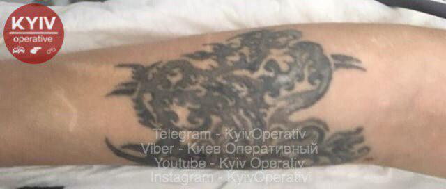 Звалилася з висоти: у Києві знайшли скалічену жінку з татуюванням