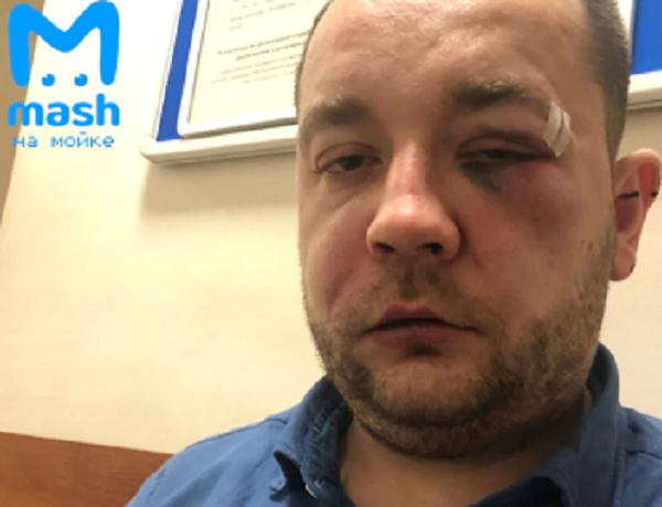 Головою об капот: у Росії таксист жорстоко розправився з пасажиром