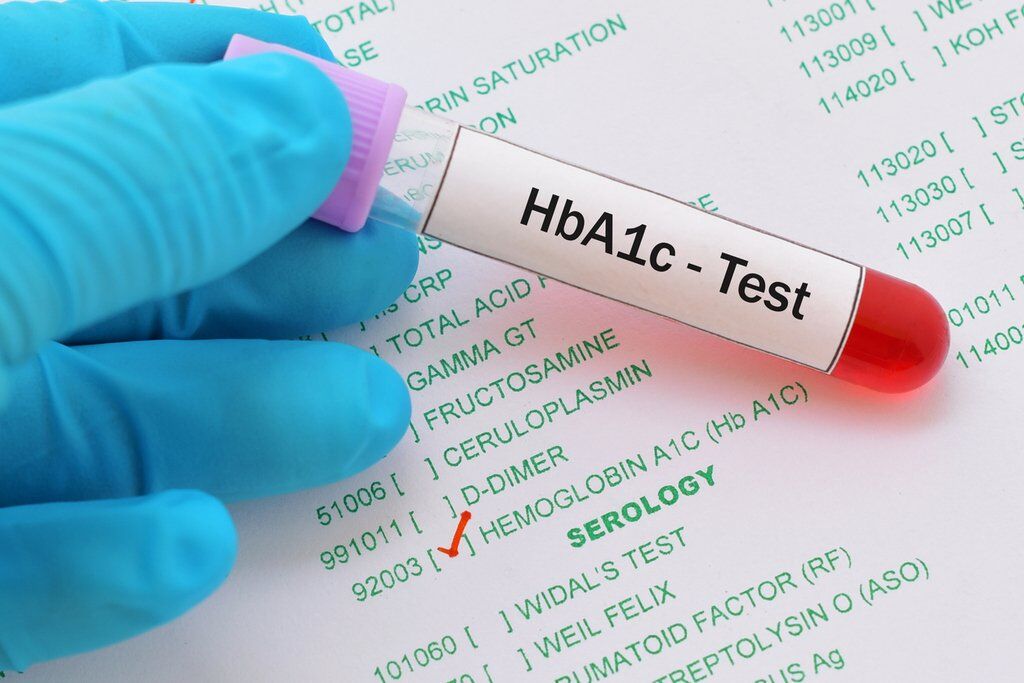 Тест на глікірованний гемоглобін (HbA1c) показує рівень цукру в крові протягом декількох останніх місяців