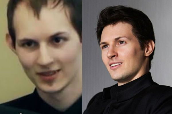 Павел Дуров до и после пластики