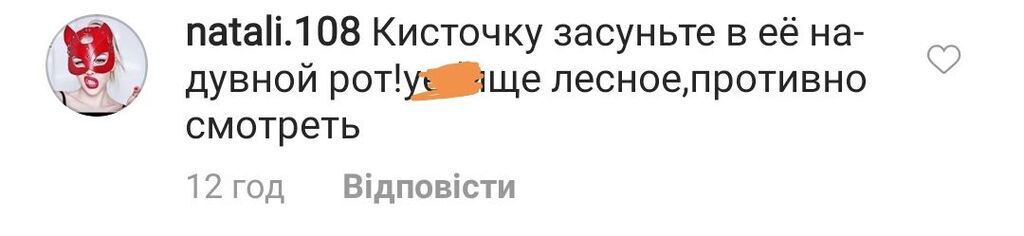 "Обличчя пластмасове!" Лорак розбурхала мережу зовнішністю