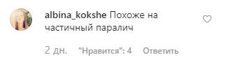 Відома російська співачка шокувала опухлим обличчям: відео