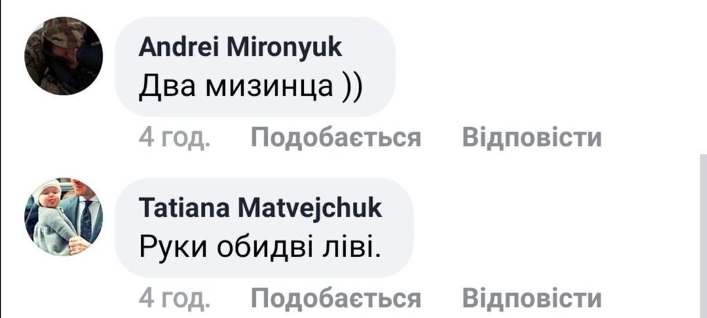 "Рептилоїд?" Дивне фото Лорак без пальця на руці спантеличило мережу