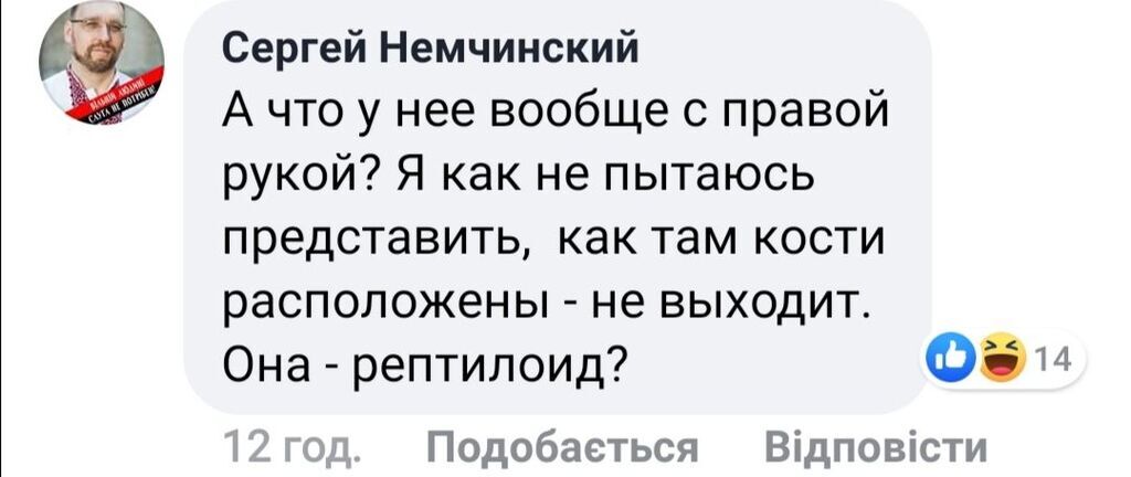 "Рептилоїд?" Дивне фото Лорак без пальця на руці спантеличило мережу