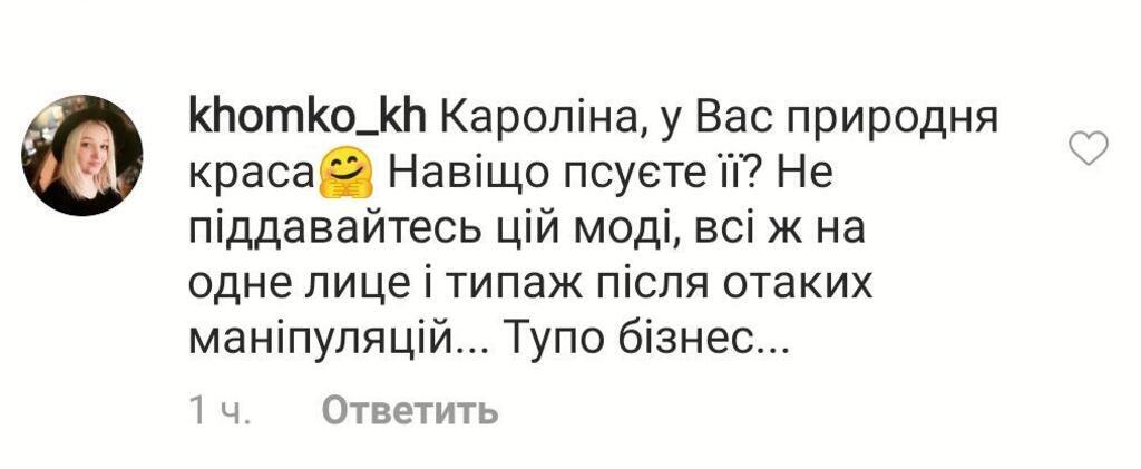 "Воскова лялька": Лорак жахнула зовнішнім виглядом на новому фото