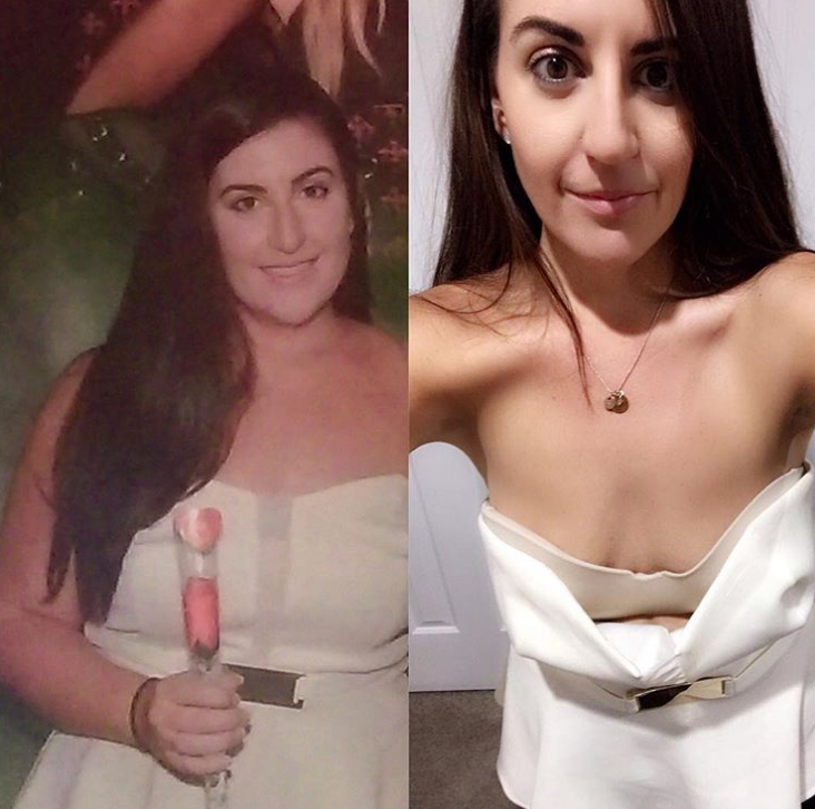 Австралийка в платье, которое еле застегивалось - до и после
