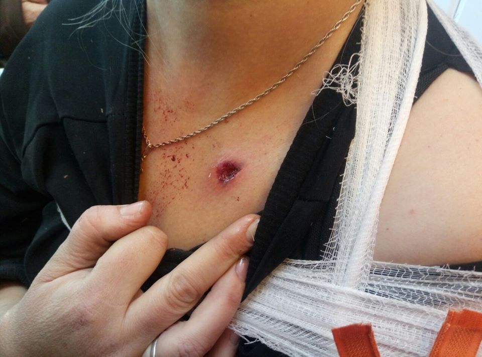 В Марьинке местная жительница получила ранения