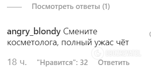 Звезда "Бедной Насти" изменилась до неузнаваемости