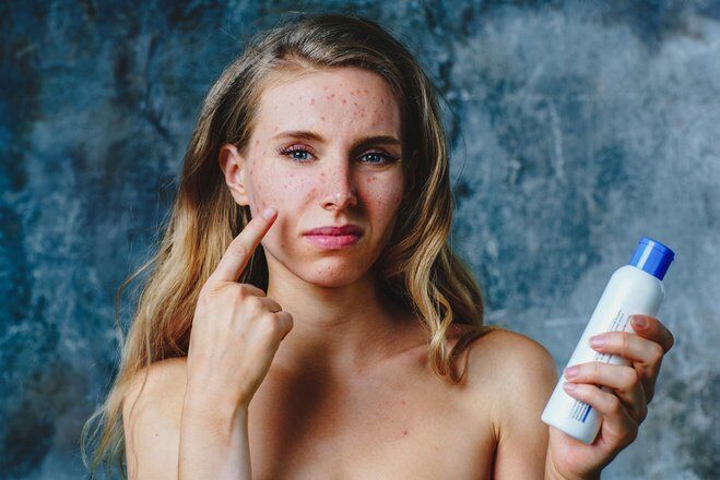 Аллергия на косметику: как ее предотвратить