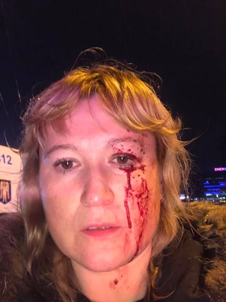 Переломы челюсти и ребер: жертвы лобового ДТП в Киеве поделились жуткими подробностями