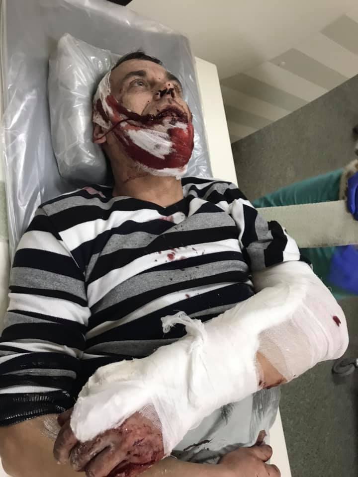 Переломы челюсти и ребер: жертвы лобового ДТП в Киеве поделились жуткими подробностями