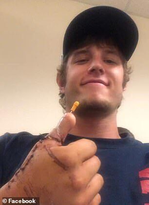 Ейден Адкінс – великий палець на руці з ноги