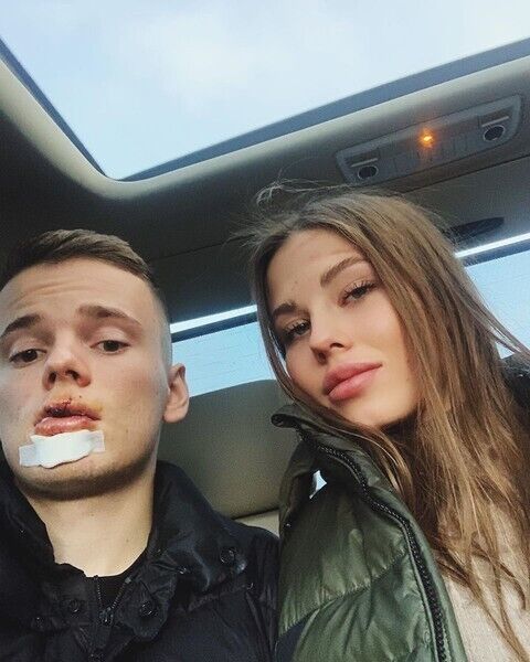 Арсеній Шульгін і його дівчина після аварії