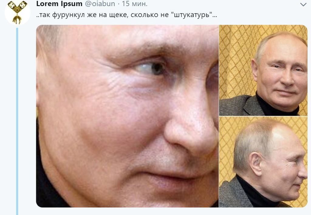 "Почки отказывают?" Путин озадачил сеть внезапно изменившимся лицом. Фото