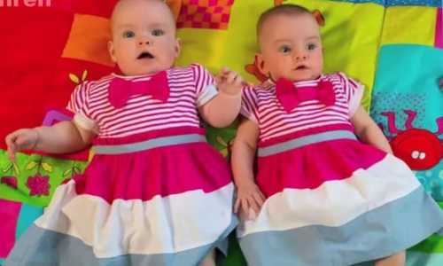 Феноменальные близнецы, которых занесли в книгу рекордов Гиннесса: фото, видео