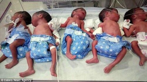 Женщина родила пять близнецов неожиданно для себя  (фото, видео)