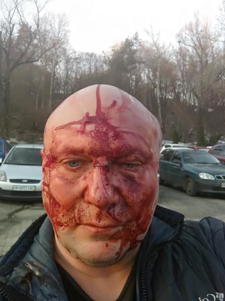 Скандальний київський догхантер загримів до лікарні. Фото 18+