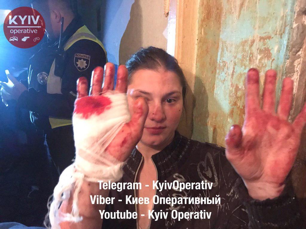 Кровь залила всю квартиру: в Киеве устроили жестокую поножовщину. Фото 18+