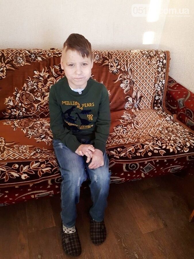 Вижив після удару струму в 27 тисяч вольт: на Миколаївщині батьки кинули в лікарні обпеченого сина