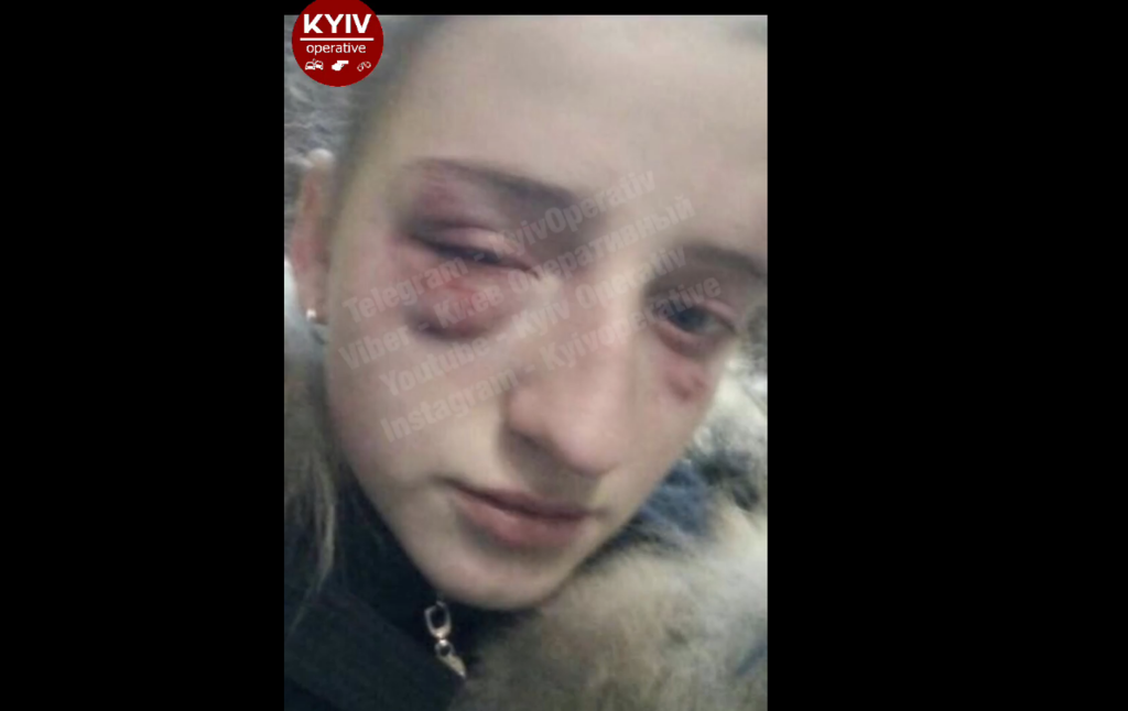 Травмы потерпевшей