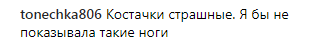 "Как у мужика!" Обнаженные ноги Лободы вызвали споры в сети